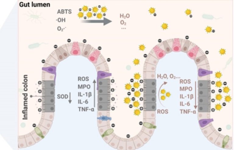 Gold Could Hold the Key to Inflammatory Bowel Disease Treatment That’s Cheaper and Non-Invasive