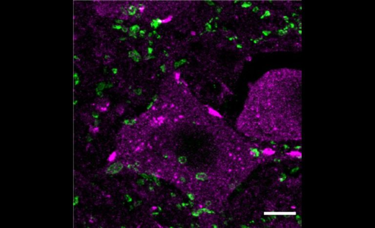 Revolutionary Jab that Could Repair Spinal Cord Injuries Developed by Scientists