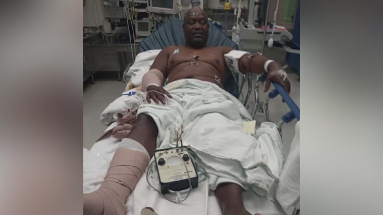 ‘They’d have killed my John’  Dallas man hospitalized after dog attack