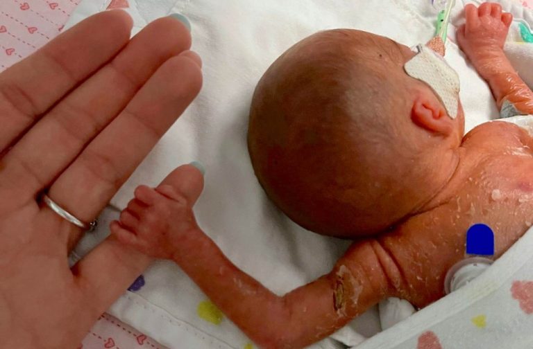 A Baby Born Weighing 1.18-lb Has Finally Come Home After Spending 4 Months in Hospital Fighting for Life (LOOK)