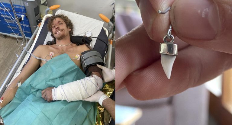 After a Shark Attack Doctors Found a Tooth in His Arm–He Now Wears it as an Earring ‘Trophy’