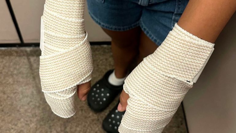 Texas school district sued over cheerleaders’ burn injuries from hot track punishment